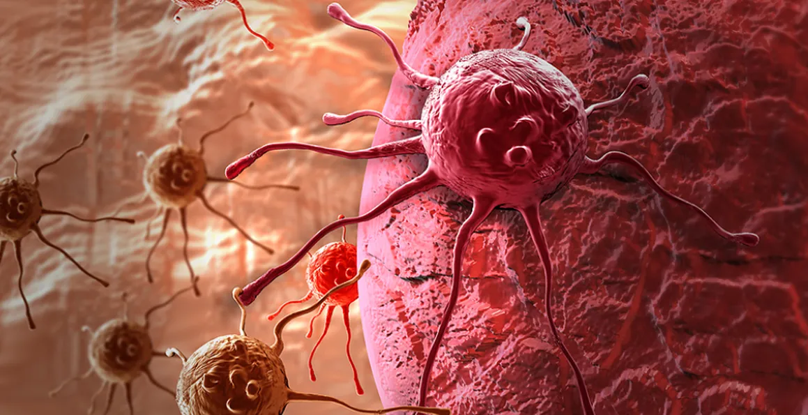 A Brief Guide to the Most Common Types of Skin Cancer