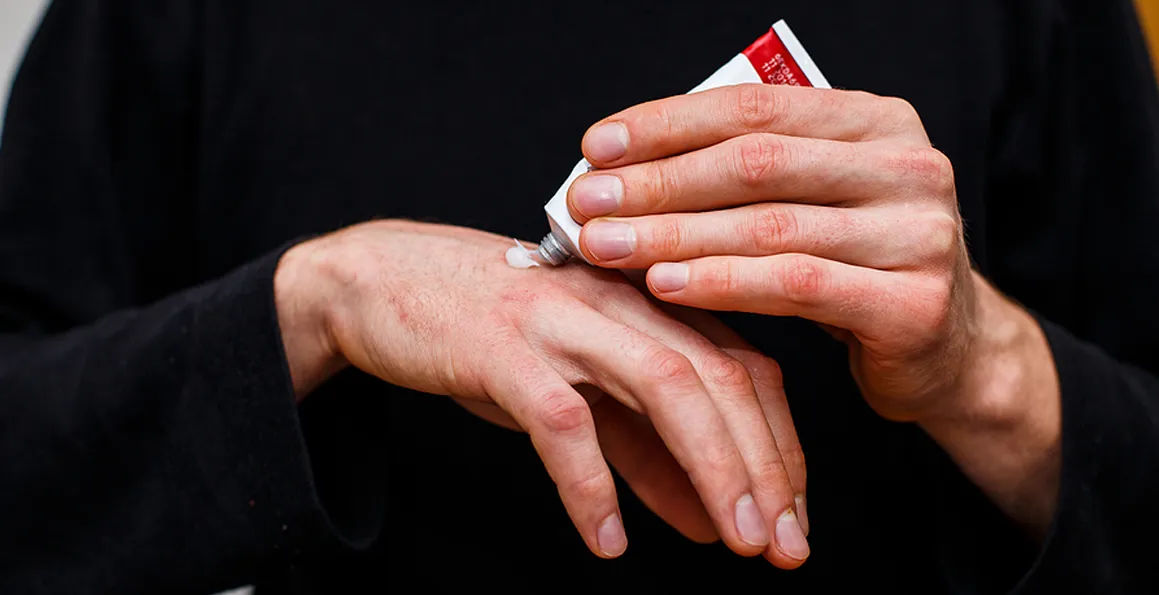 Eczema Treatment Options In Singapore: What Really Works?