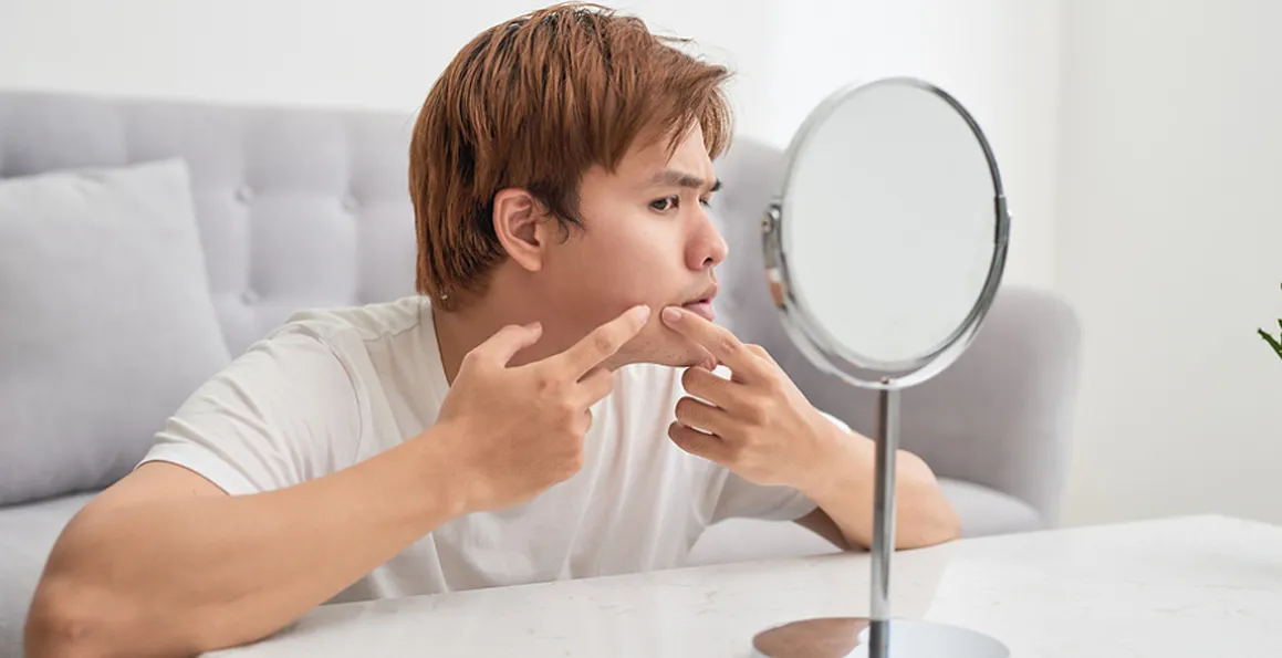 Is This Acne Or Not? Acne & Other Facial Rashes That Mimic Acne