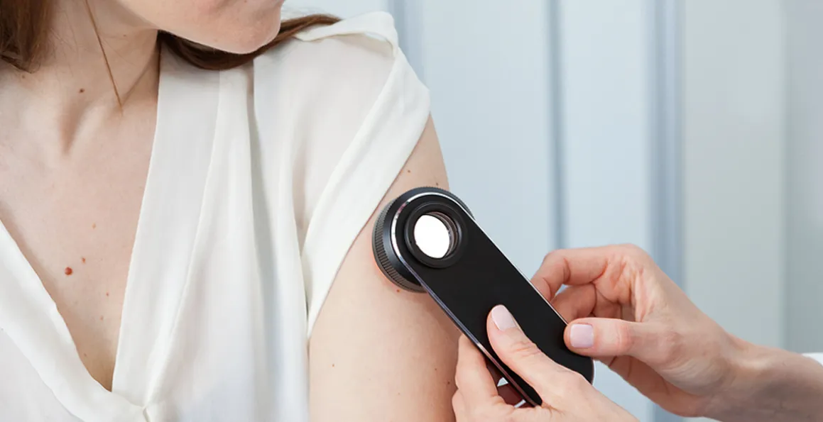 Skin Cancer: Is It Curable If Detected Early?