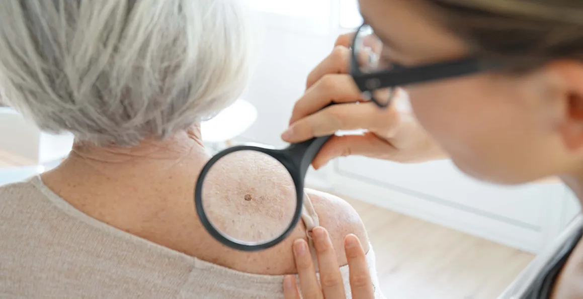Why Routine Skin Check-Ups Are Vital For Skin Health