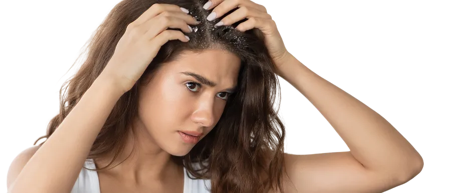 Dandruff Treatment in Singapore