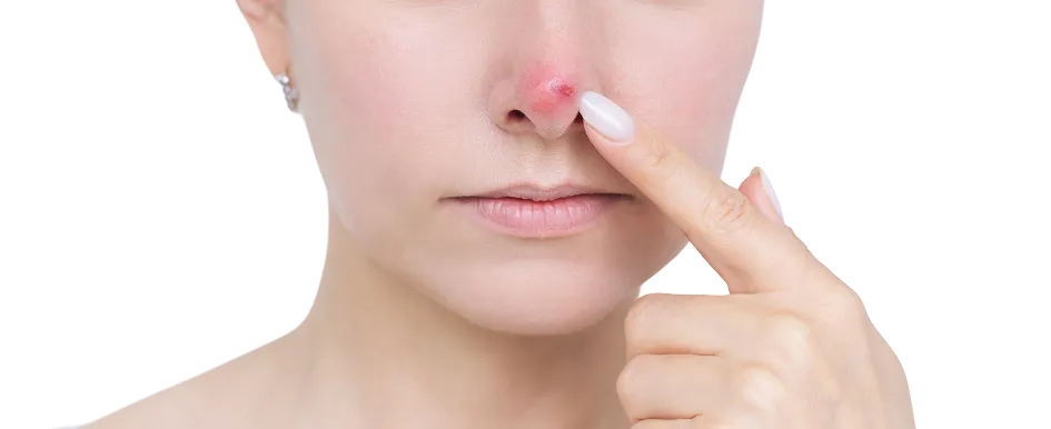 Mohs Micrographic Surgery in Singapore