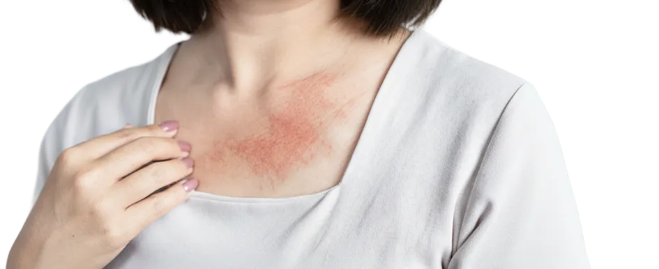 Treatment for Skin Infections in Singapore