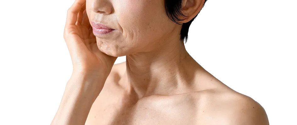 Wrinkle Treatment in Singapore
