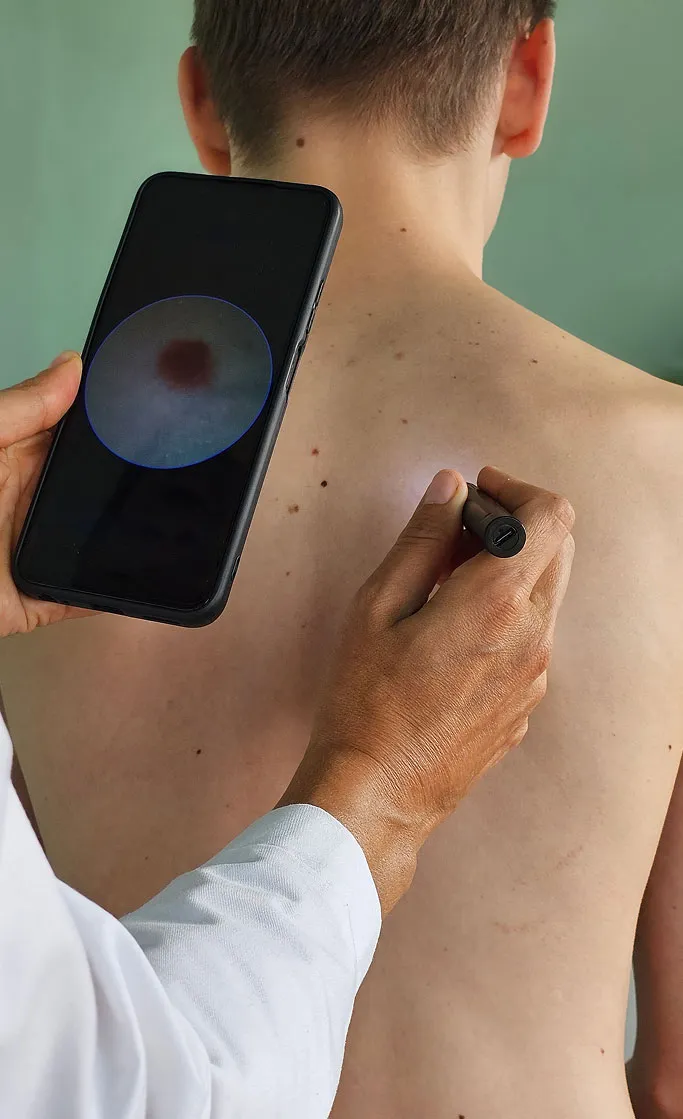 How Are Skin Infections Treated at TSN Dermatology?