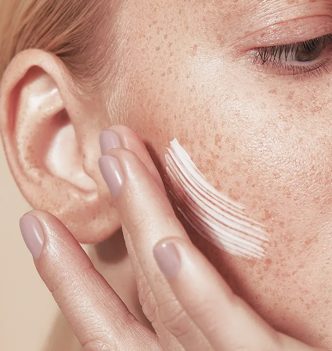 How is Skin Pigmentation Treated at TSN Dermatology?