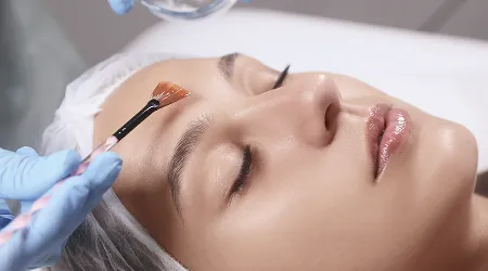 Chemical Peels