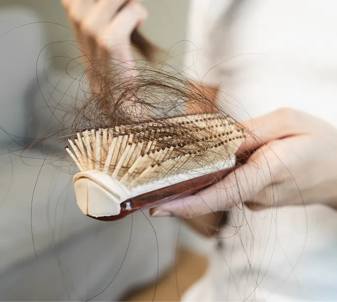When Should You See a Dermatologist for Hair Loss?