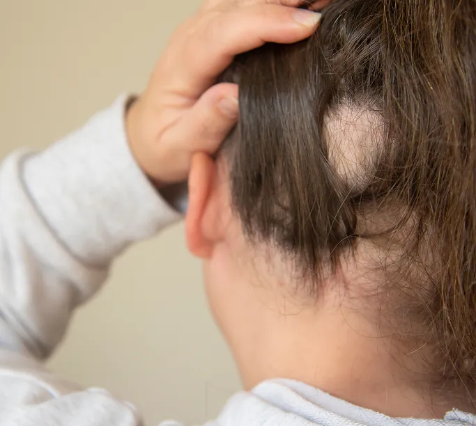 When Should You See a Dermatologist for Hair Loss?