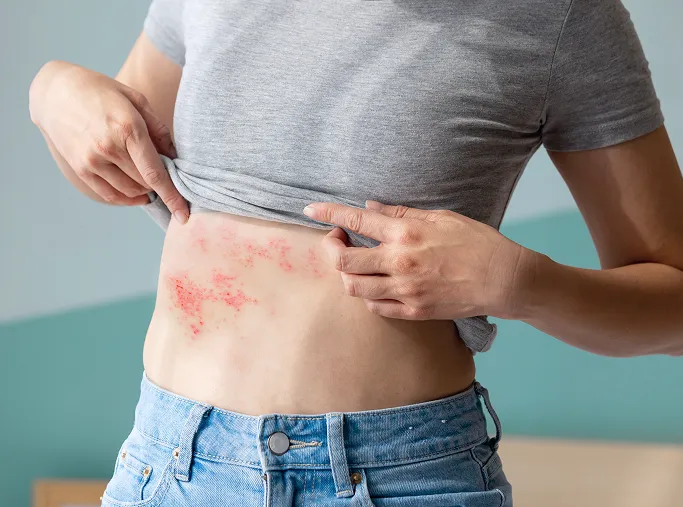 When Should You See a Dermatologist for Skin Allergies?