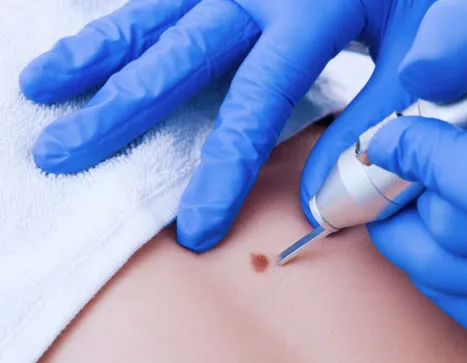 Surgical Dermatology