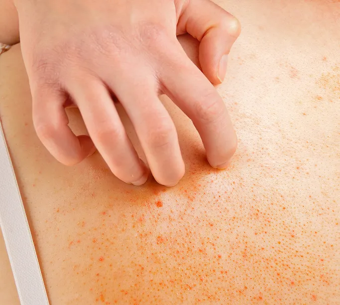 Common Symptoms of Benign Skin Growth to Look Out For