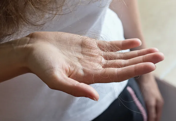 Common Symptoms of Hair Loss to Look Out For