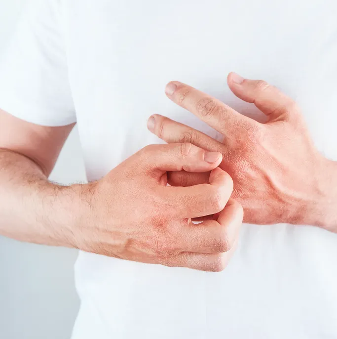 Common Symptoms of Skin Allergies to Look Out for