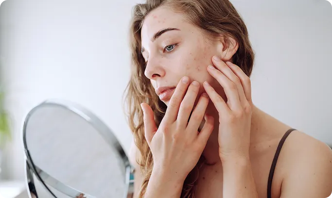 What Are Ache Scars?